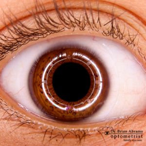 emergency eye doctor